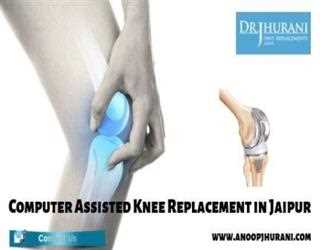 Computer Assisted Knee Replacement in Jaipur Total Knee Replacement Surgery