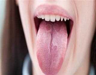 Dolor en la lengua después de comer piña