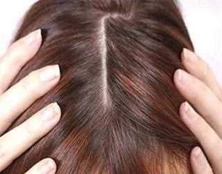 Get Rid of Your Dandruff In The Best Way