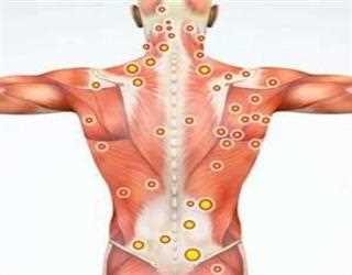 Dry Needling or Acupuncture: Which Treatment Is More Beneficial