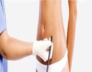 Laser Liposuction: Benefits Vs Side Effects