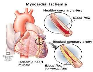 Which is the most dangerous disease you know?