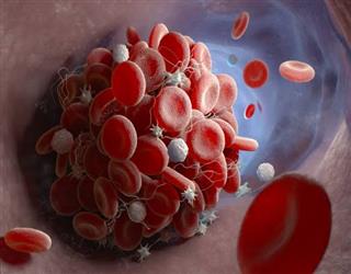Researchers Explain Blood Clotting Following COVID-19 Immunization.