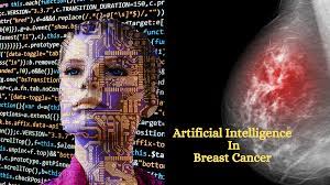 How Artificial Intelligence is helping to diagnose breast cancer